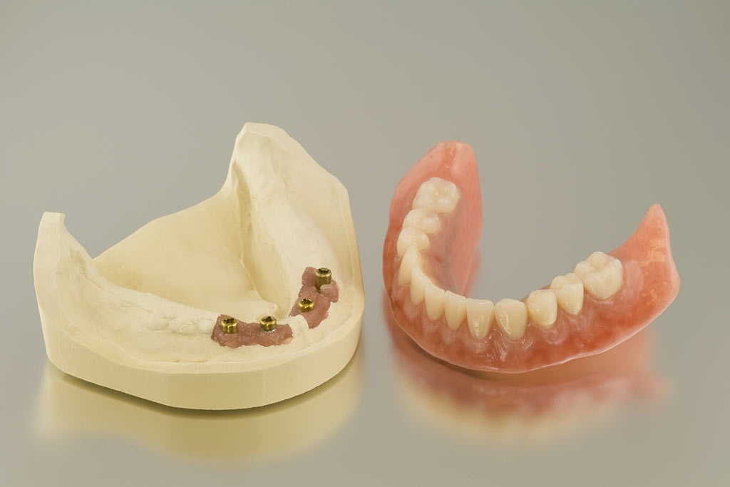 Denture cleaning DIYs you shouldn’t try