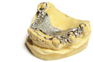 denture with wire mesh