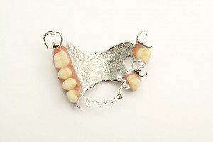 Titanium partial dentures at Vernon Denture Clinic