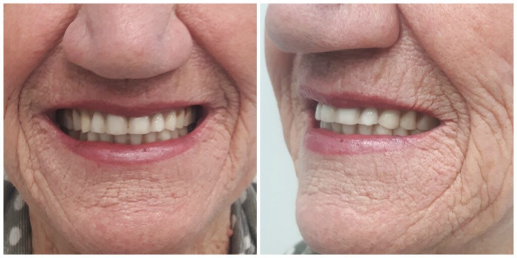 Patient before treatment