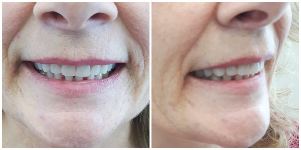 Patient after treatment