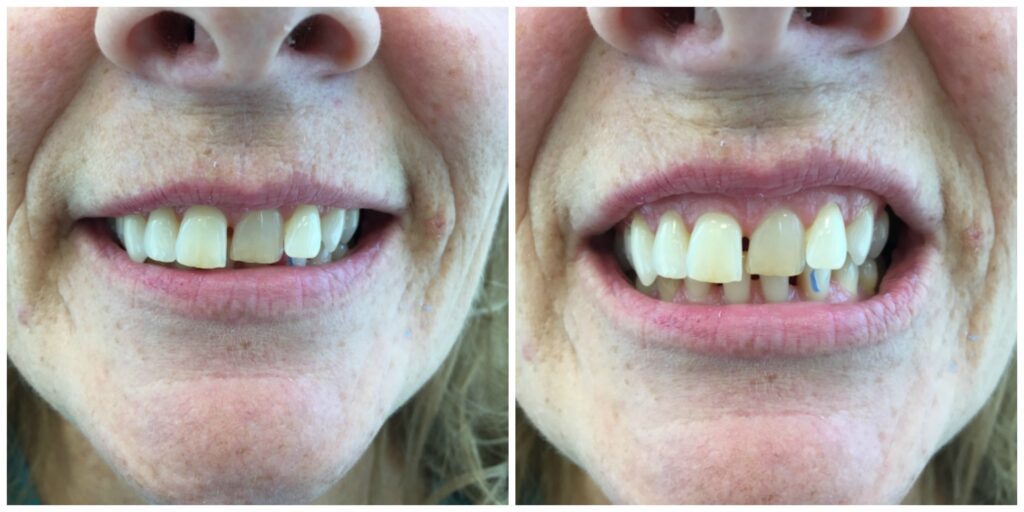 Patient before treatment