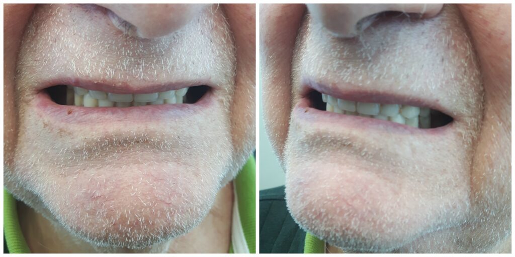 Patient before treatment