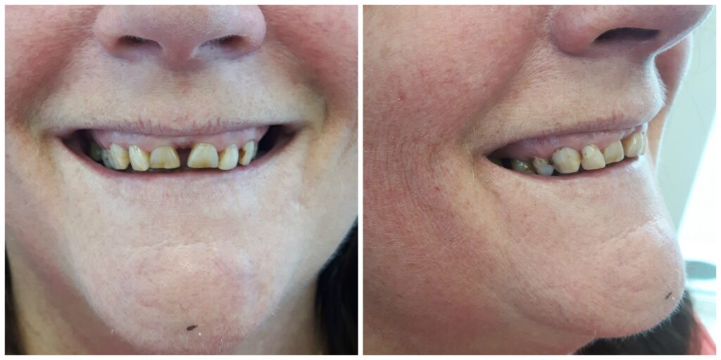 Patient before treatment