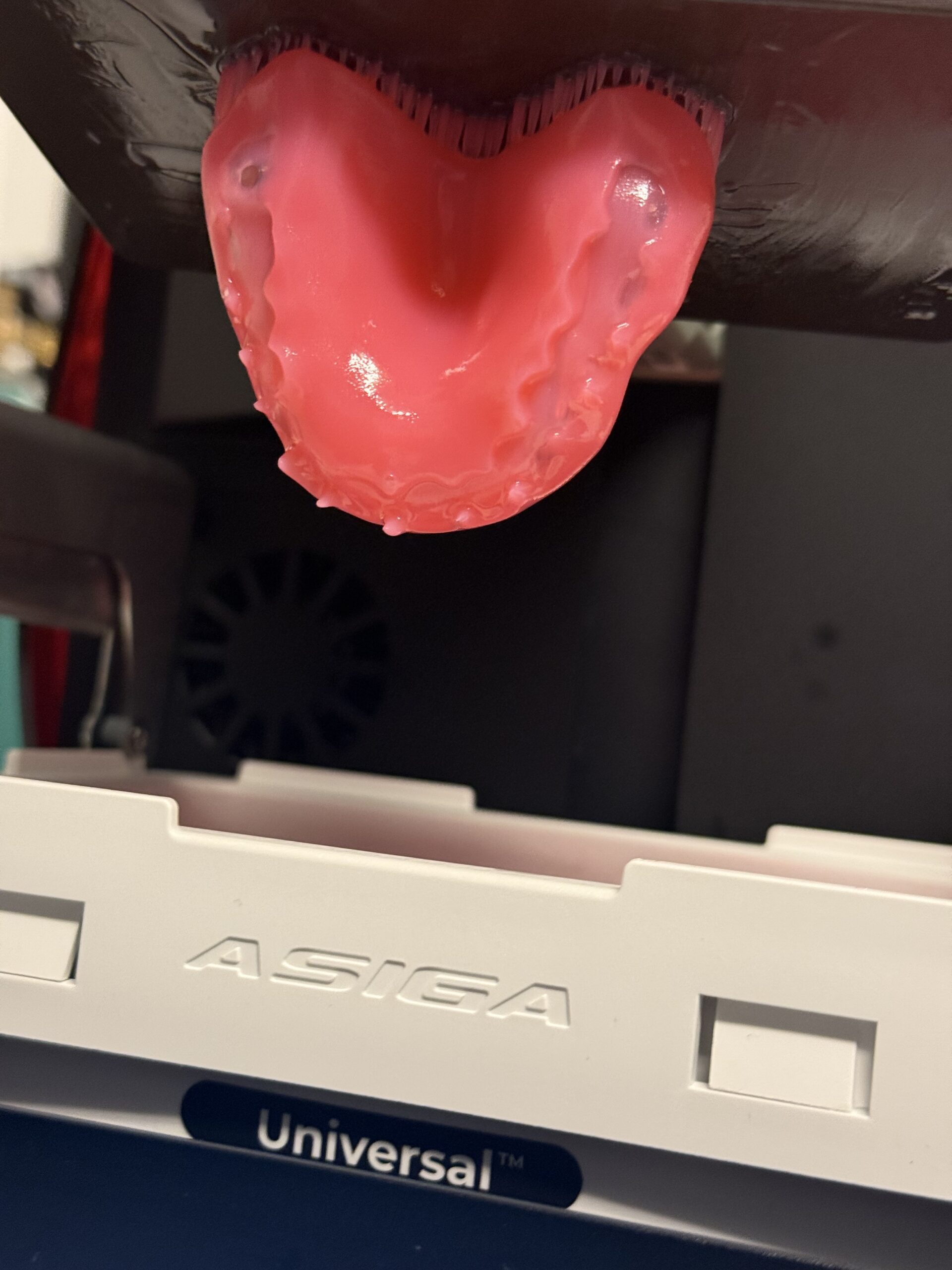 Digital Dentures Kelowna